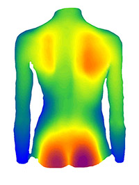 3-D Wirbelsäulenvermessung